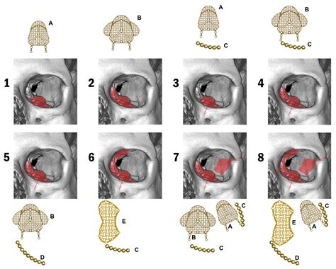 The Orbital Destruction Intensity Classification—An Easy-to-Use ...