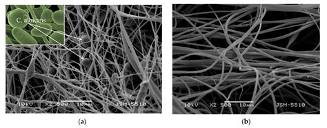 Electrospun Materials Based on Cellulose Acetate Loaded with Rosmarinic ...