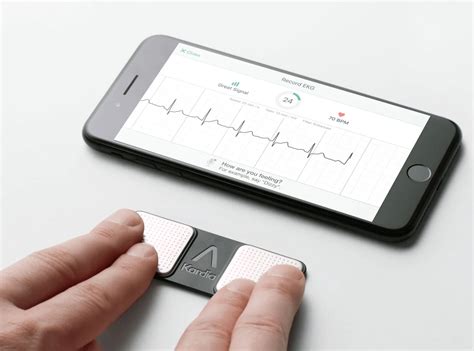 How To Read An Ekg Monitor | Robots.net