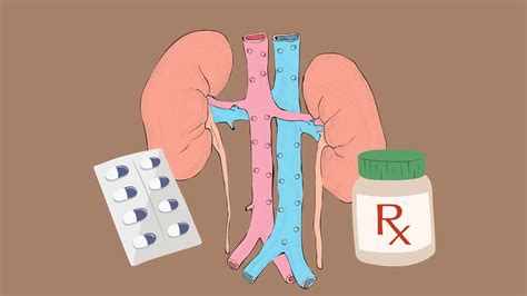 Tamsulosin for Kidney Stones: A Comprehensive Guide