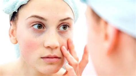 Lupus strongly linked to imbalances in gut microbiome - HEALTH ...