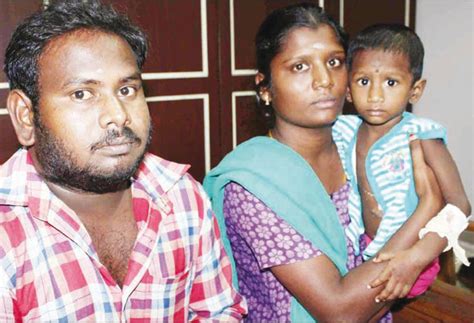 Intestinal surgery of a 1-year-old infant for the first time at Erode ...
