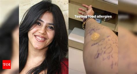 Ekta Kapoor takes food allergy test; reveals she is allergic to ...