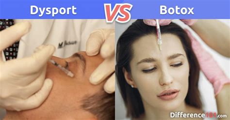 Dysport vs. Botox: What’s The Difference? | Difference 101