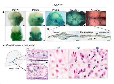 Control of craniofacial development by the collagen receptor, discoidin ...