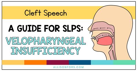 Velopharyngeal Insufficiency: A Guide for SLPs and SLPAs