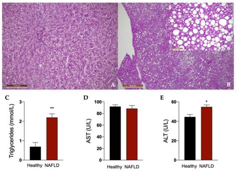 The Metabolic Activation of Sofosbuvir Is Impaired in an Experimental ...