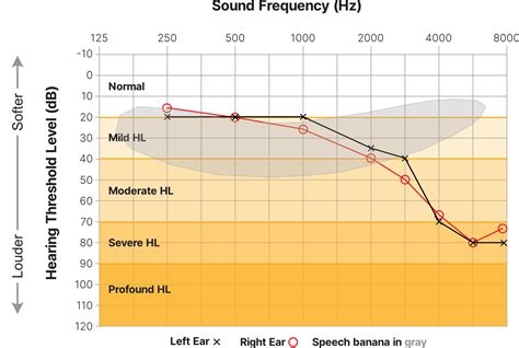 Understanding Your Audiogram: What Do Those Results Mean?