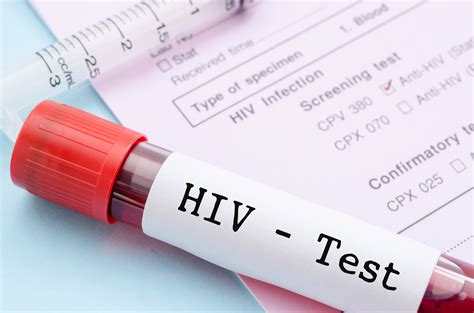 Should I get HIV tested | Signature OB/GYN