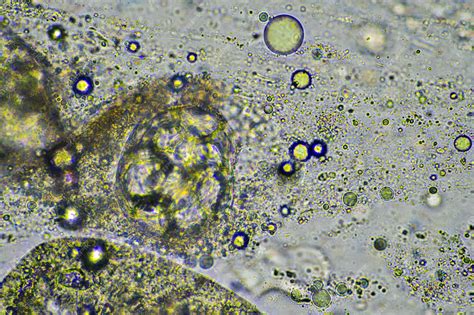 Tossir moco y flema de una infección de pecho de una infección por ...