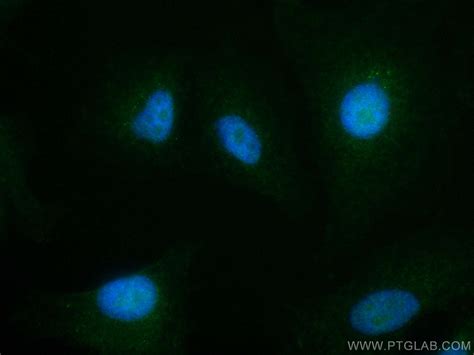 RDM1 antibody (CL488-66941) | Proteintech