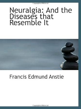 Neuralgia: And the Diseases that Resemble It : Amazon.in: Books