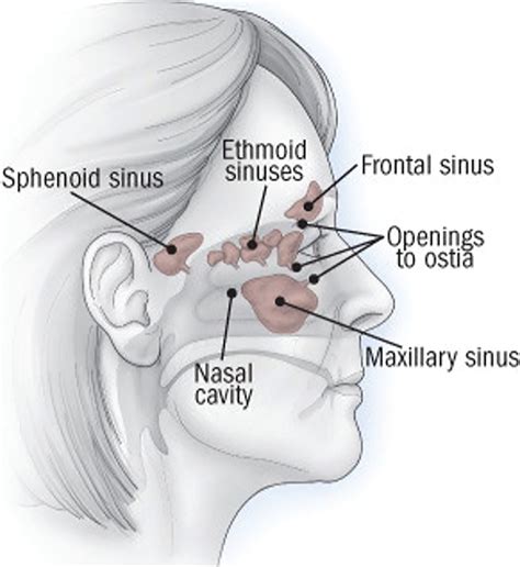 Sphenoid Sinus Infection