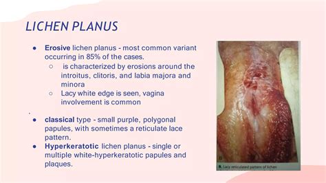 Benign Gynecologic Lesions.pptx