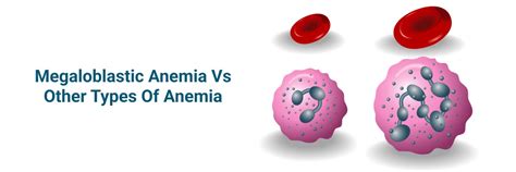 Anemia ya Megaloblastic dhidi ya Aina Nyingine: Tofauti Muhimu
