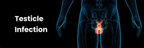 Testicle Infections: Causes, Symptom and Treatment