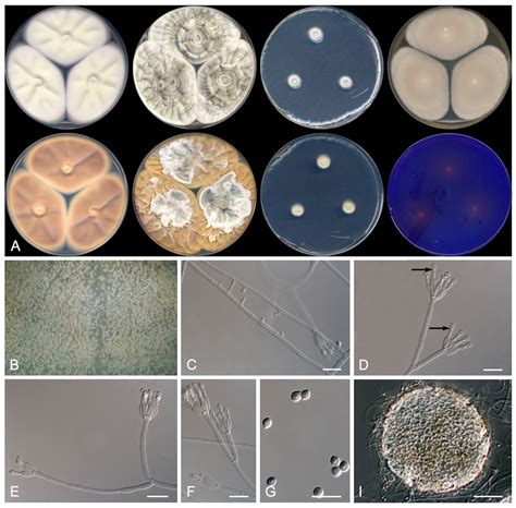 Microscopio Penicillium Notatum Microscopic Observation Of Fungi. (a)