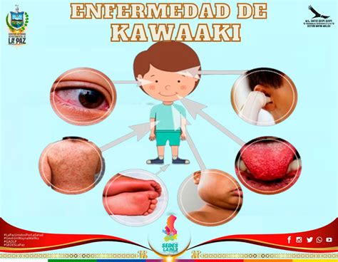 DÍA MUNDIAL DE LA ENFERMEDAD DE KAWASAKI – SEDES LA PAZ