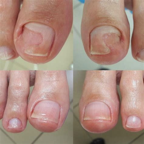 Pedicure description and picture gallery – Feet & Hands by Lidia