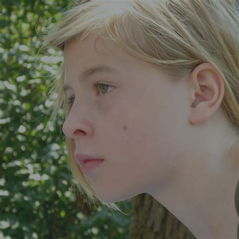 What causes those ugly liver spots on your face, also known as age spots? - Women of Wisdom Magazine