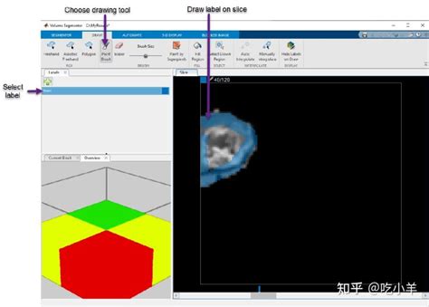 Image result for Volume Segmenter MATLAB Tutorial