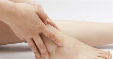 Itchy ankles: Causes, rash, and treatment