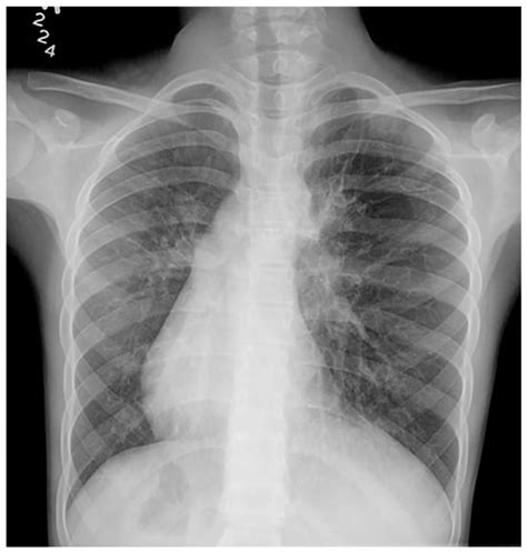 World-Renowned “Swiss” Pediatricians, Their Syndromes, and Matching ...