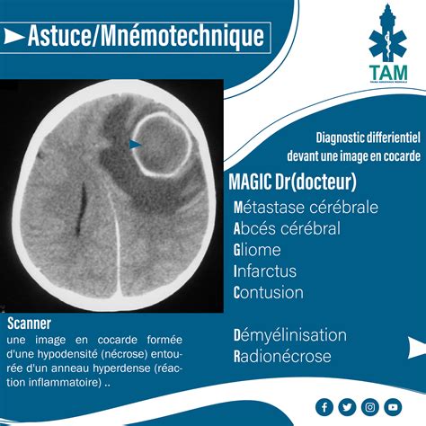 Image result for Scanner Cerebral Avec Injection Diode