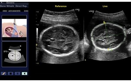 LOGIQ V2 | GE Healthcare