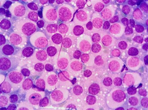 How American dogs disappeared and left behind a contagious cancer