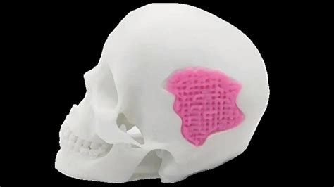 Scientists 3D print bio-glass with skeletal strength