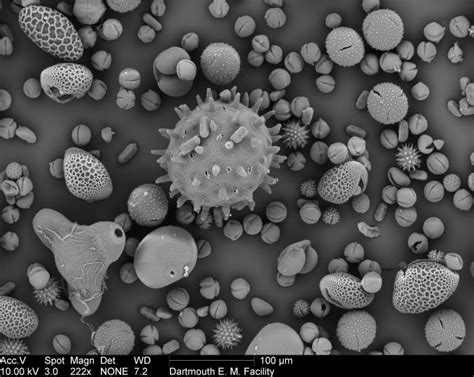 Image result for Electron Microscope Images
