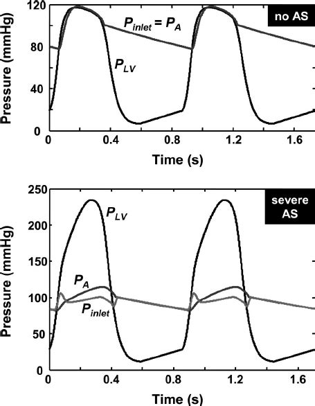 Image result for Multi Dynamic Vena Modeling