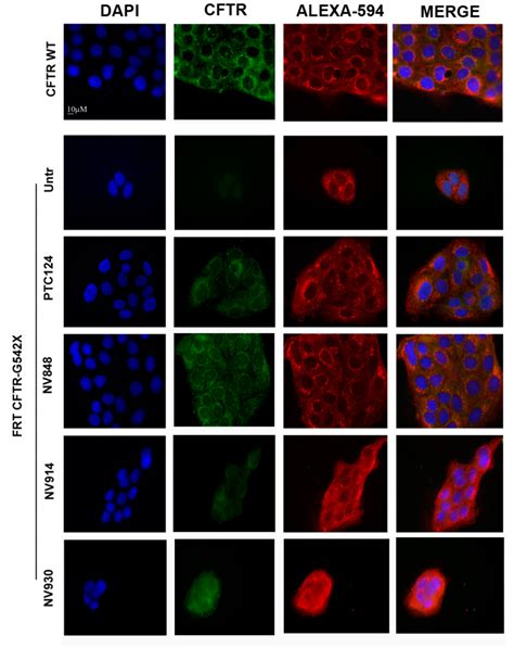 Targeting Nonsense: Optimization of 1,2,4-Oxadiazole TRIDs to Rescue ...