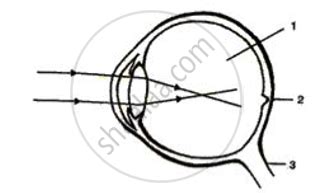 Given Below is a Diagram Showing a Defect of Human Eye. Study It And ...