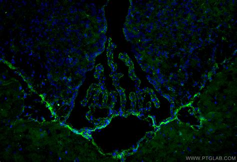 ZO-1 antibody (21773-1-AP) | Proteintech