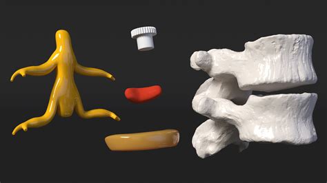 Stand with Herniated Spinal Vertebrae 3D | 3D Molier International