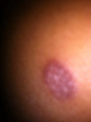 Image result for Alien Invasyndrome Female