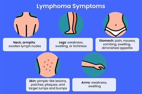 Follicular Lymphoma Symptoms