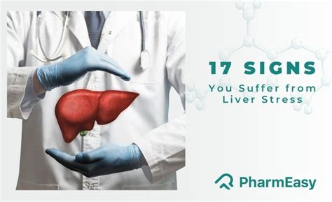 17 Signs of Liver Stress You Need to Know | PharmEasy