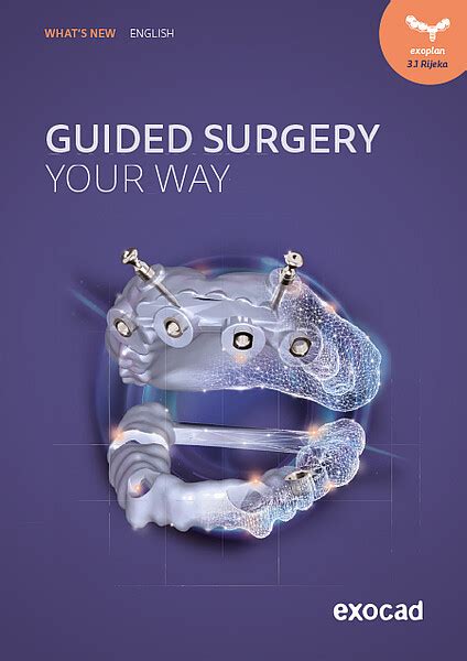 Exoplan Tutorial 的图像结果