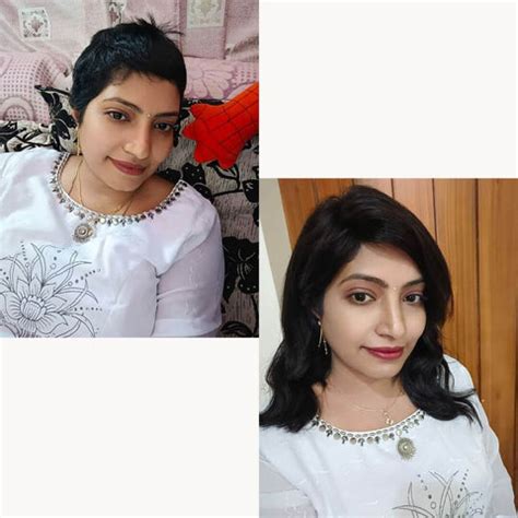 Difference Between Crown Coverage and Hair Wigs - The Gorgeous Hair ...