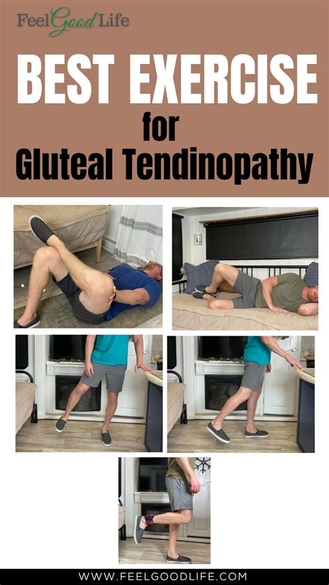 Trochanteric bursitis 12 best exercises and stretches – Artofit