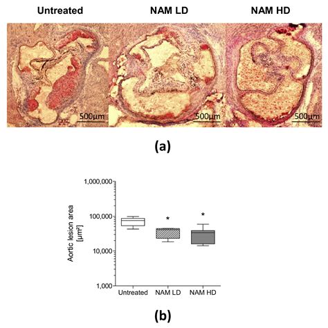 Nicotinamide Prevents Apolipoprotein B-Containing Lipoprotein Oxidation ...