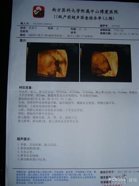 怀孕32周胎儿B超图-怀孕8个月胎儿b超图_补肾参考网