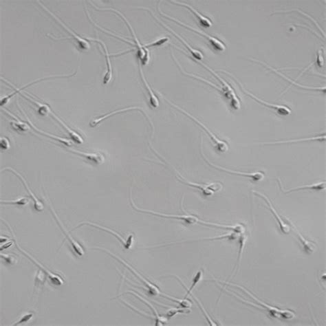 Microscopes for Semen Analysis