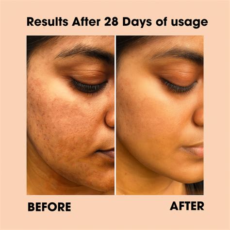 4 Steps skin care set – MK MART