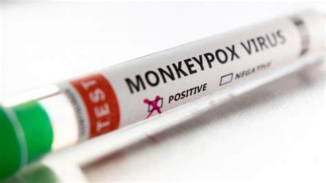 US CDC expects global monkeypox cases to be over 700