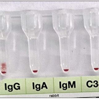 Image result for Dat Positive