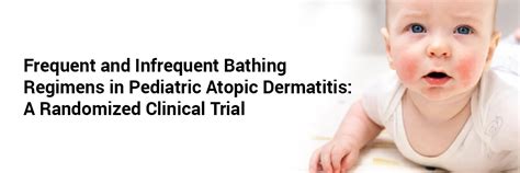 Frequent and Infrequent Bathing Regimens in Pediatric Atopic Dermatitis ...